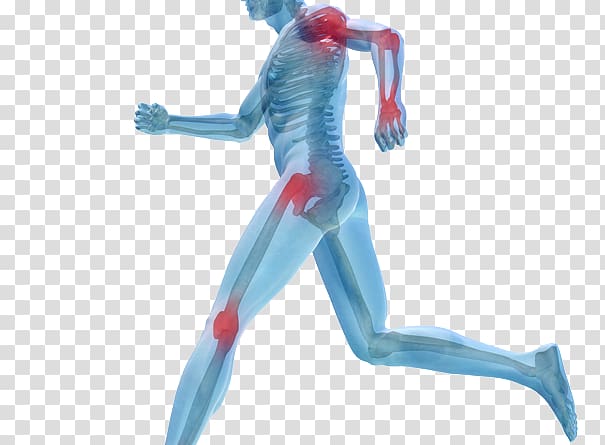 Human body Joint pain Knee pain Platelet-rich plasma, sport injury transparent background PNG clipart