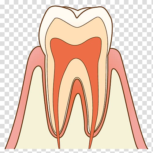 歯科 Dentist Tooth brushing Tooth decay Therapy, tooth cavity transparent background PNG clipart