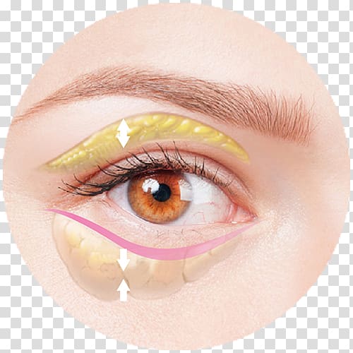 Face Eye Skin Enophthalmia Medicine, double eyelids transparent background PNG clipart