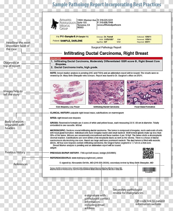 Surgical pathology Surgery Digital pathology Biopsy, pathology lab transparent background PNG clipart