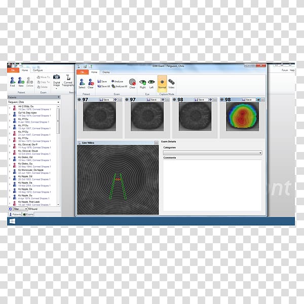 Corneal topography Surveyor Computer Software Orthokeratology, others transparent background PNG clipart