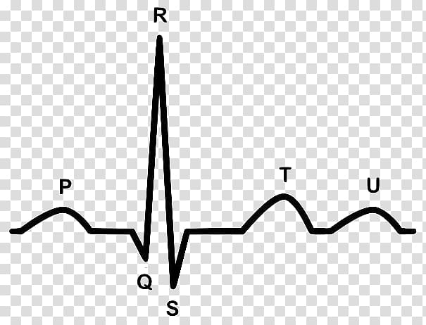 Electrocardiography Heart arrhythmia Cardiology Cardiovascular disease, heart transparent background PNG clipart