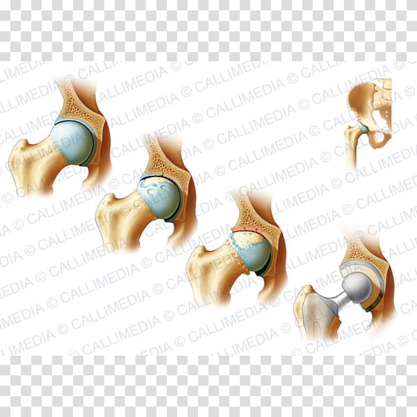 Bone fracture Cat Arthritis Clavicle fracture Rheumatology, Cat transparent background PNG clipart