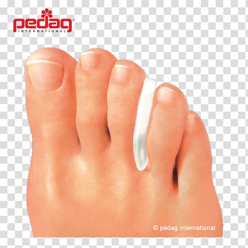 Corn Toe Bent finger Leg Bunion, corn transparent background PNG clipart