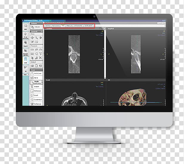 Computer Software Computer Monitors Data European Institute for Biomedical Imaging Research, x-ray machine transparent background PNG clipart