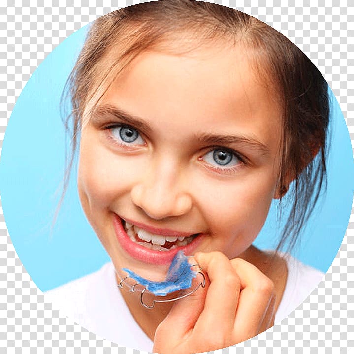 Orthodontics Dentistry Clear aligners Retainer Dental braces, child transparent background PNG clipart