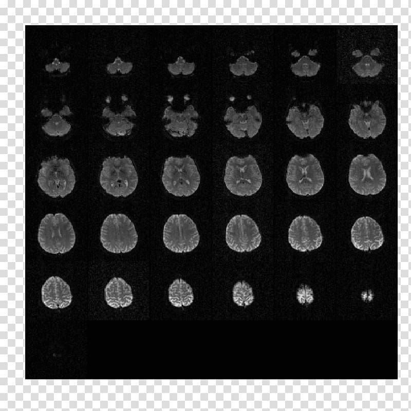 DICOM Single-n emission computed tomography Magnetic resonance imaging, mosaic transparent background PNG clipart