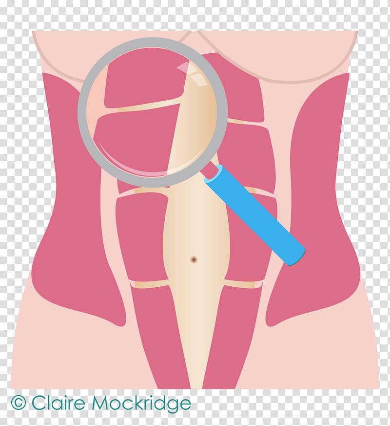 Diastasis recti Hip Abdomen Rectus abdominis muscle, abdominal movement transparent background PNG clipart