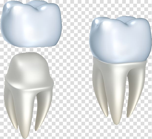 Crown Cosmetic dentistry Dental restoration, Restorative Dentistry transparent background PNG clipart