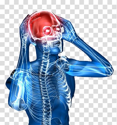 Migraine Hand Headache Disease, hand transparent background PNG clipart