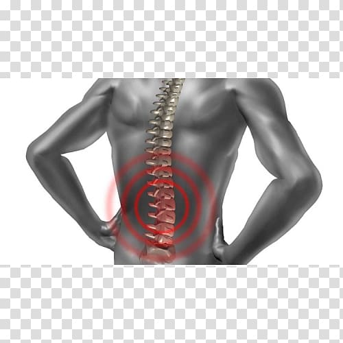 Back pain Physical therapy Vertebral column Acupuncture Human back, others transparent background PNG clipart