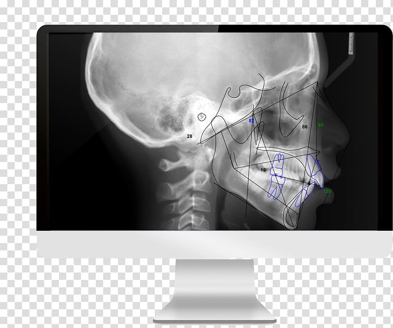 Medical imaging Cone beam computed tomography Radiography, others transparent background PNG clipart