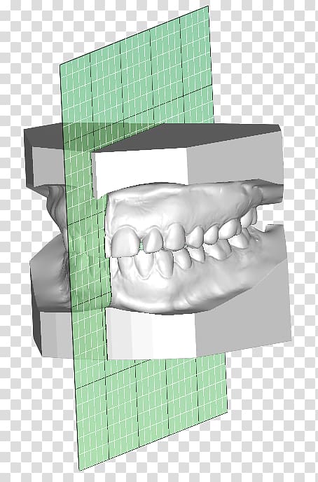 Orthodontics Laboratory Clear aligners Jaw Mouthguard, others transparent background PNG clipart