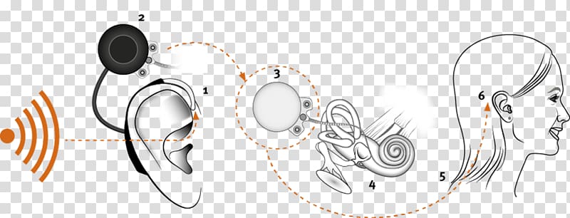 Cochlear implant Sound, ear transparent background PNG clipart