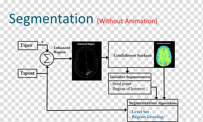 segmentation Brain tumor Magnetic resonance imaging Neoplasm, Segmentation transparent background PNG clipart