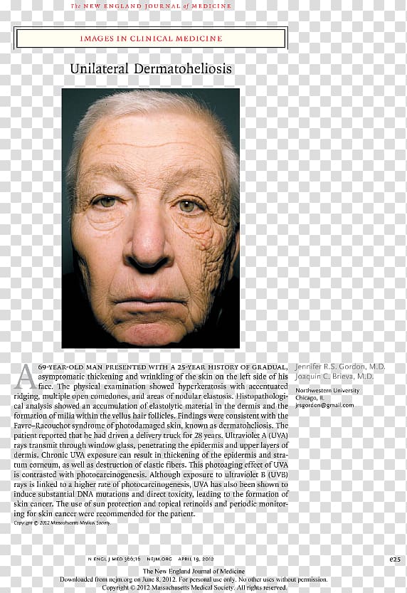 aging Ultraviolet Skin care Truck driver, Face transparent background PNG clipart