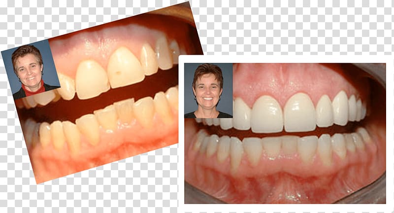 Markham, Dr. Kevin M Kevin R. Markham DDS Dentist Unionville Tooth, dental smile transparent background PNG clipart
