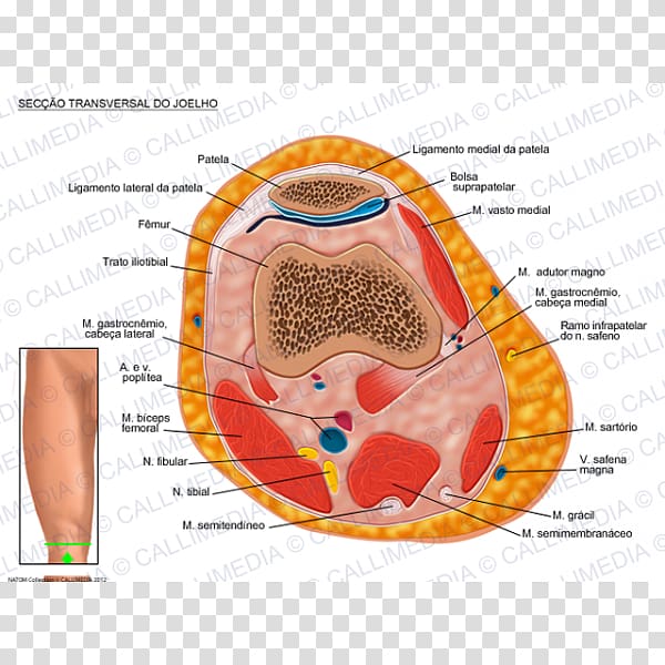 Knee Transverse plane Human anatomy Gastrocnemius muscle, artrosis de rodilla transparent background PNG clipart