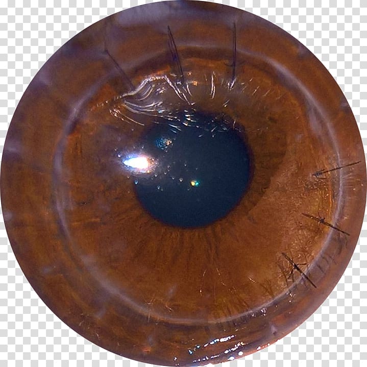 Iris Corneal transplantation Surgery Organ transplantation, Eye transparent background PNG clipart