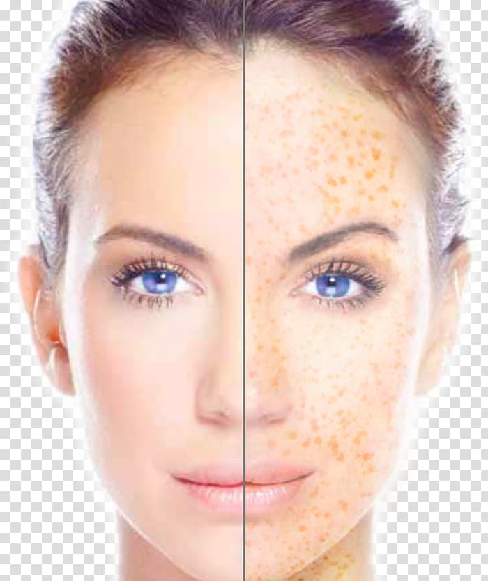 Face Facial toning Skin tag, Face transparent background PNG clipart