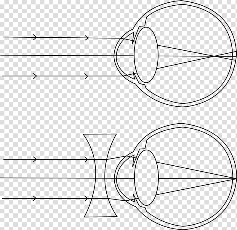 Near-sightedness Light Myopia and Hyperopia (Nearsightedness and Farsightedness) Visual perception Presbyopia, light transparent background PNG clipart