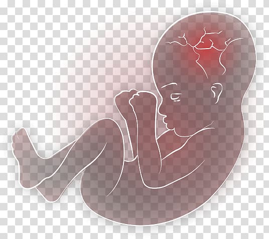 Uterus Infant Child Organ, child transparent background PNG clipart