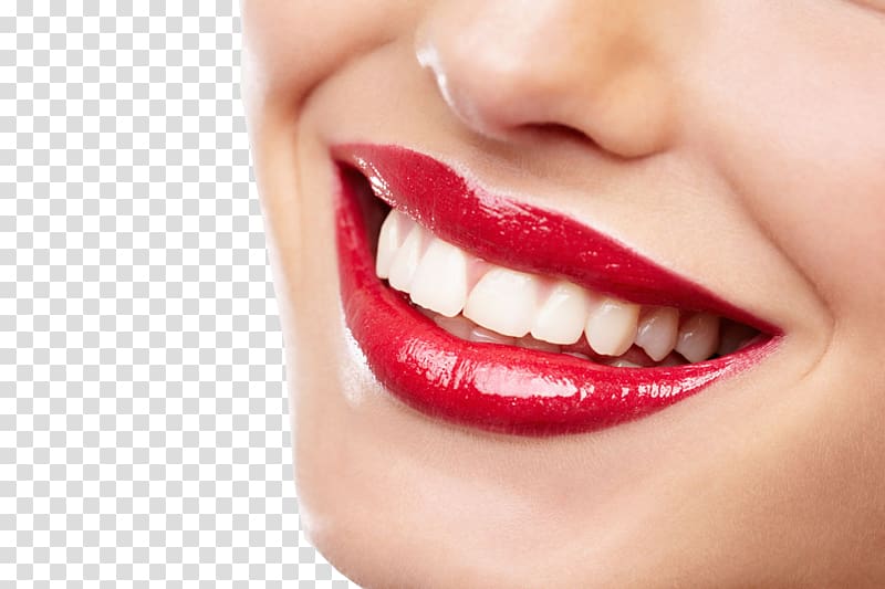 woman wearing red lipstick smiling, Bleach Tooth decay Smile Dentistry, Teeth model transparent background PNG clipart