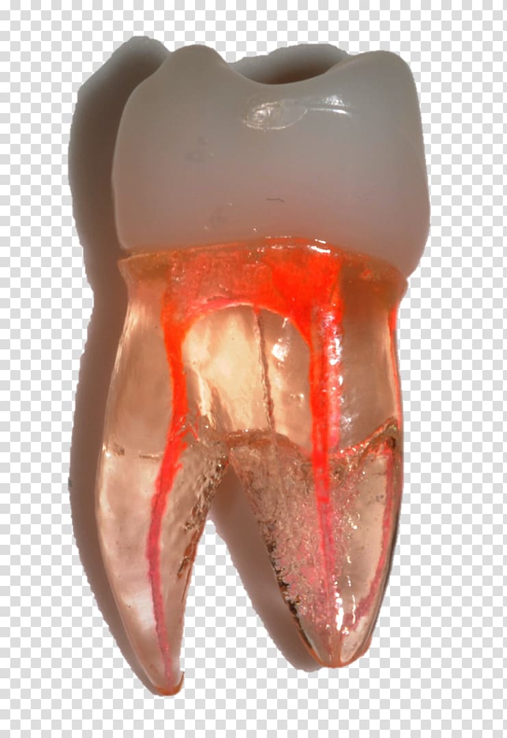 Tooth Pulp Endodontic therapy Oral hygiene Organ, dentistry transparent background PNG clipart