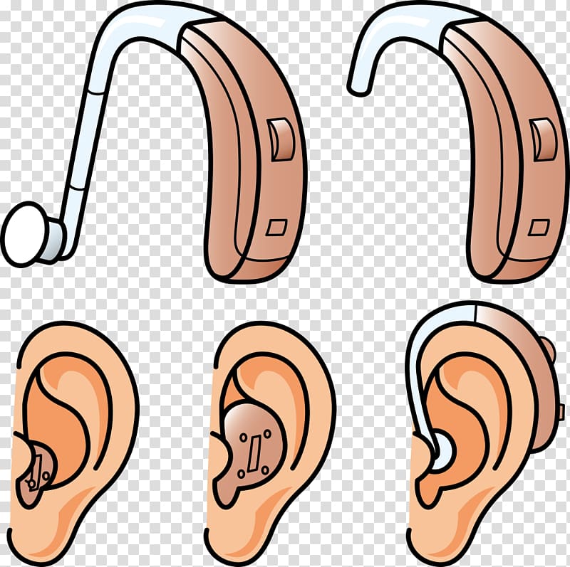 ears illustration, Hearing aid Hearing loss, ear and hearing aids transparent background PNG clipart