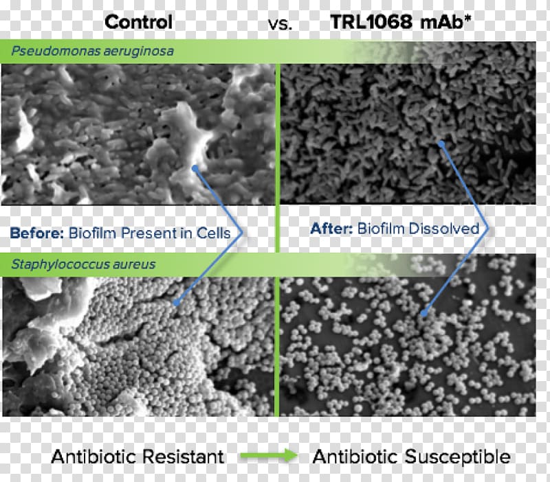 Soil Bacteria Antibody Broad-spectrum antibiotic Chemical affinity, others transparent background PNG clipart