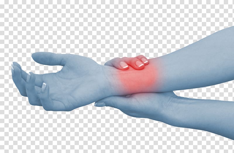 Wrist pain Hand Carpal tunnel syndrome Sprain, pain transparent background PNG clipart