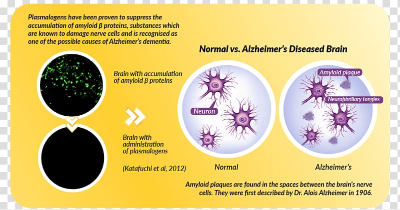 Ether Plasmalogen Alzheimer\'s disease Dementia Phospholipid, alzheimer transparent background PNG clipart