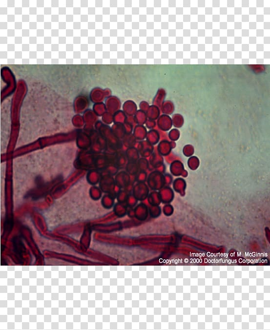 Malassezia furfur Fungus Seborrheic dermatitis Disease Skin, Malassezia transparent background PNG clipart