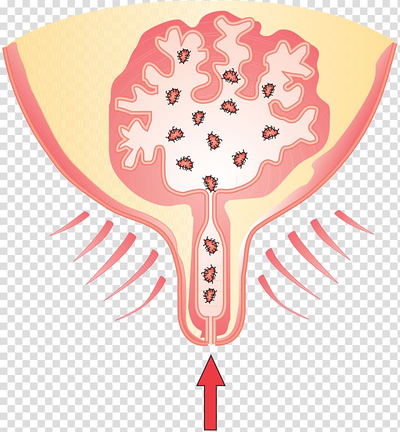 Cattle Milk Mammary gland Mastitis Bacteria, cartoon of infected bacteria transparent background PNG clipart