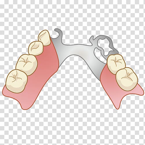 Dentures Dentist Removable partial denture Dental technician Tooth decay, tooth transparent background PNG clipart