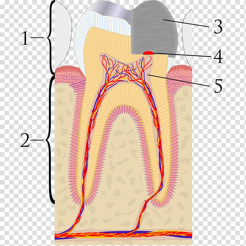 Pulp capping Pulpitis Endodontic therapy Dentist, Pulp Capping transparent background PNG clipart