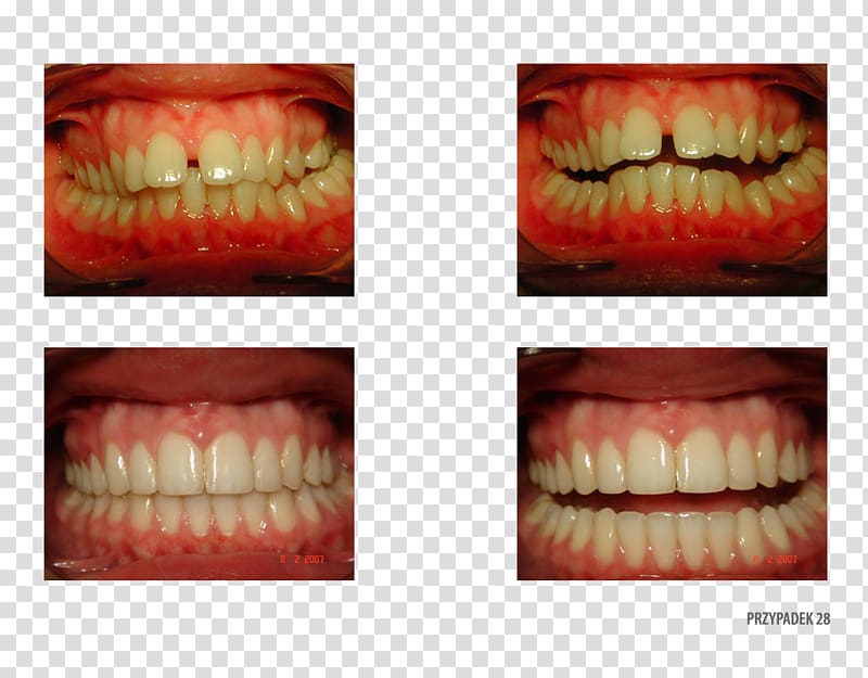 Orange Polska Tooth Close-up Therapy, orange transparent background PNG clipart