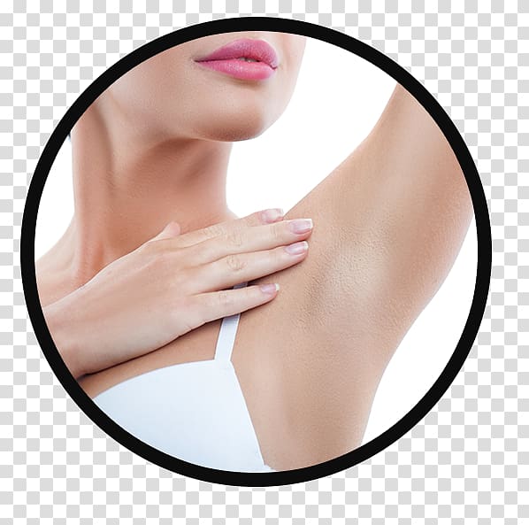 woman touching her arm pit, Hyperhidrosis Therapy Botulinum toxin Perspiration Surgery, hair removal transparent background PNG clipart