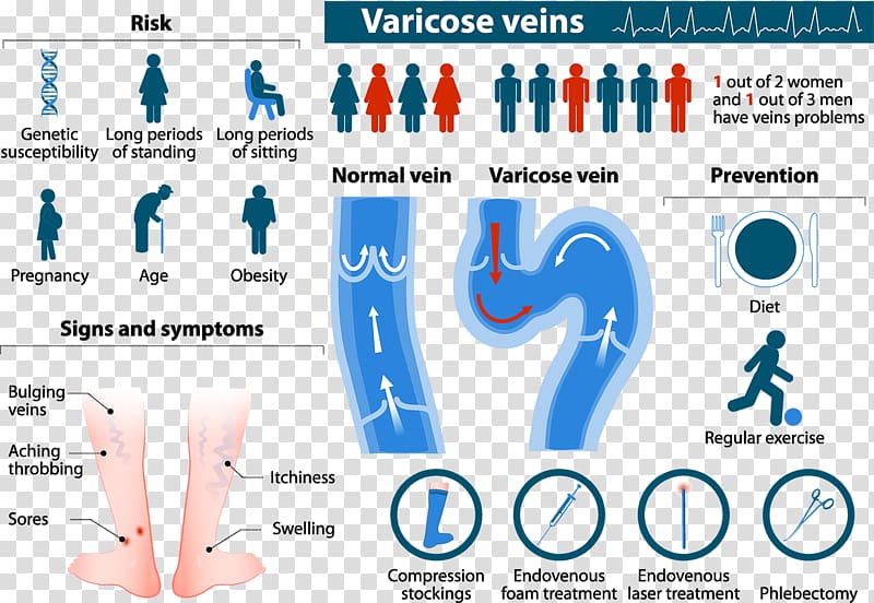 Varicose veins Telangiectasia Risk factor Therapy, others transparent background PNG clipart