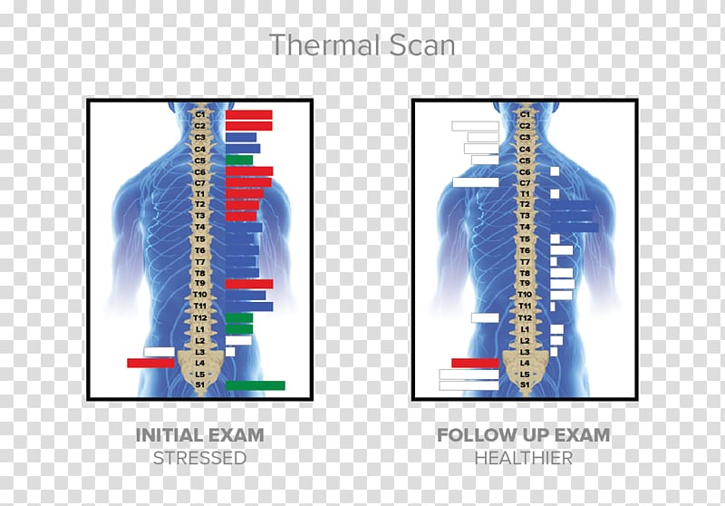 McKillican Chiropractic Chiropractor Nervous system Technology, thermal transparent background PNG clipart