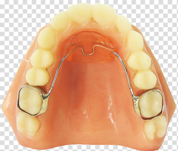 Tooth Orthodontics Orthodontic technology Clear aligners Retainer, others transparent background PNG clipart