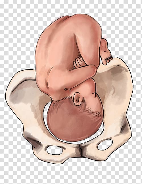 Fetal position Childbirth Infant Breech birth, pregnancy transparent background PNG clipart