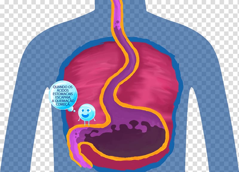 Burning Chest Pain Stomach Gastroesophageal reflux disease Indigestion Body, others transparent background PNG clipart