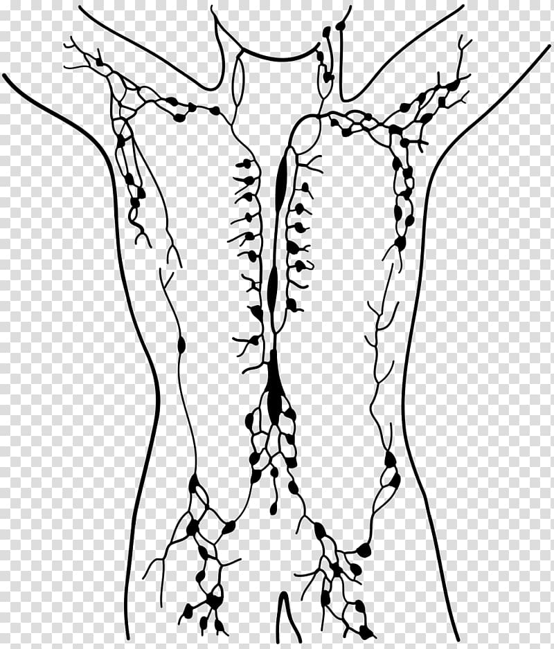Lymphatic system Manual lymphatic drainage Lymphatic vessel Lymph node, swollen transparent background PNG clipart