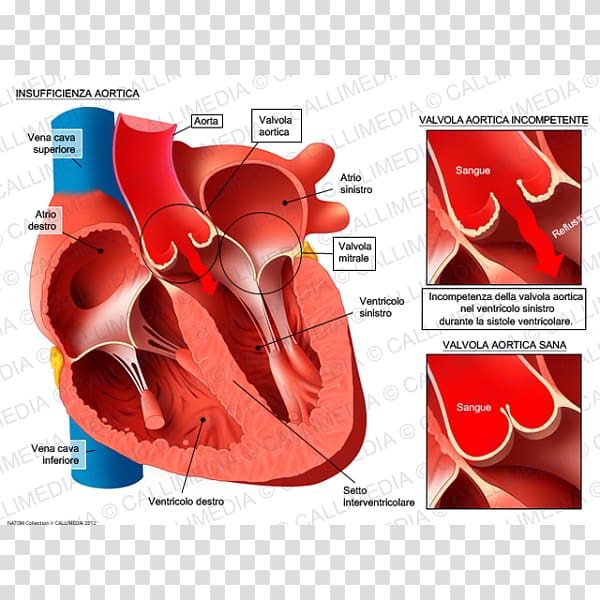 Valvular aortic stenosis Aortic insufficiency Aortic valve Mitral insufficiency Mitral valve, heart transparent background PNG clipart