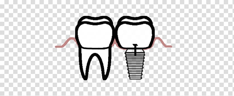Dent Oral Max Dentistry Oral medicine Tooth Dental implant, Missing Teeth transparent background PNG clipart