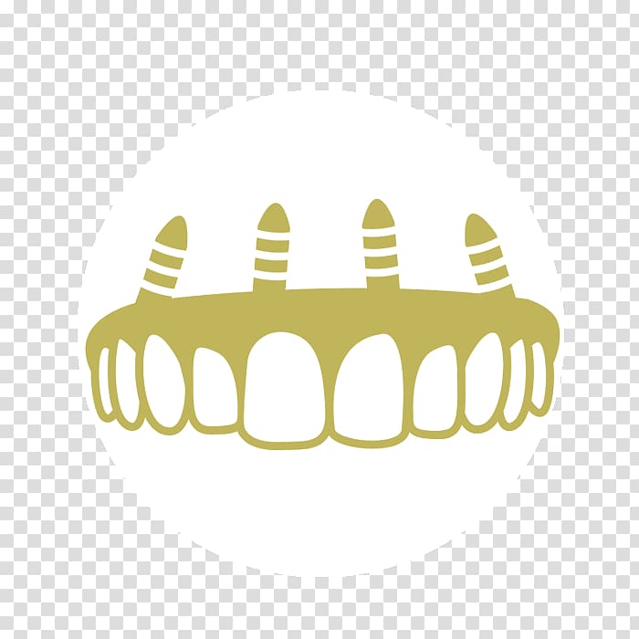 All-on-4 Dental implant Dentistry Tooth Dentures, Oral And Maxillofacial Surgery transparent background PNG clipart