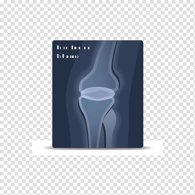 Bone Orthopedic surgery Hospital, Sign bone chip shot transparent background PNG clipart