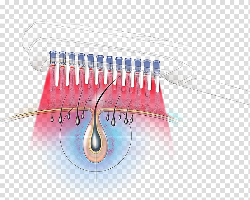 Comb Laser diode Hair Brush, Follicle transparent background PNG clipart
