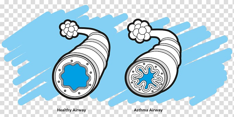 Asthma spacer Nursing care plan Disease , Asthma transparent background PNG clipart